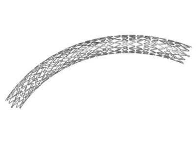 nitinol
