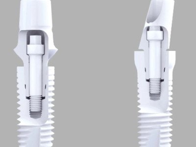 Zirconia Dental Implants